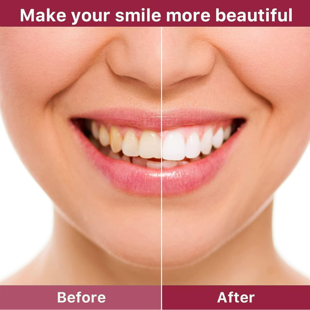SP 4 UltraBrightening Toothpaste, Advanced Whitening Formula for Stain Removal and Enamel Protection| Fresh Mint Flavor| 120g